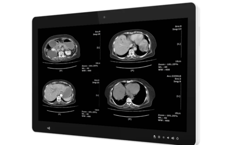 Itium Screen Medical 23,8’’