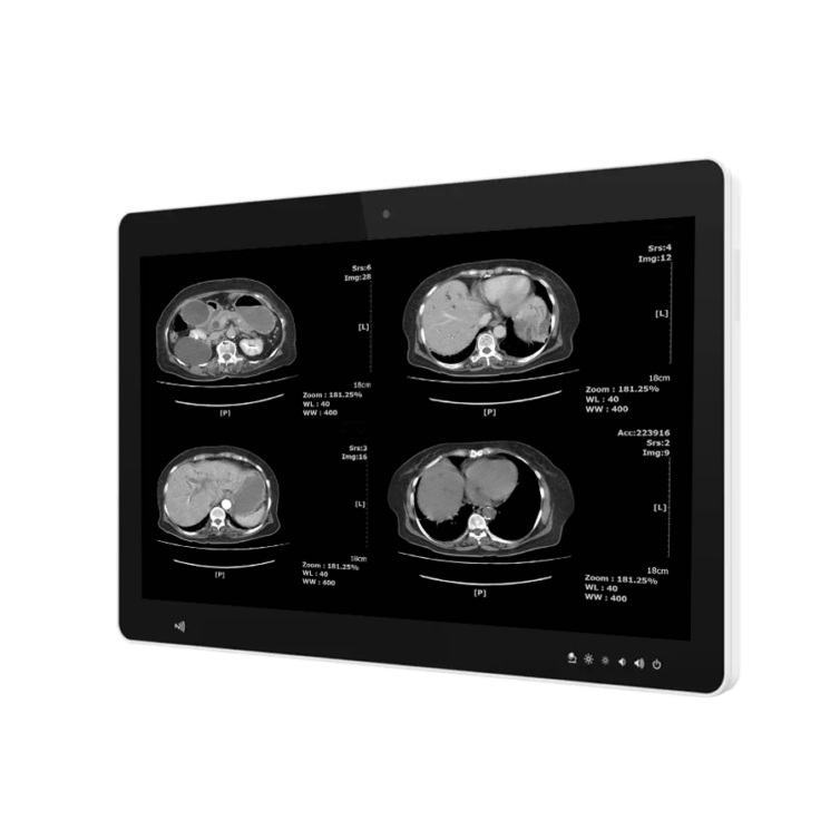 Itium Screen Medical 23,8’’